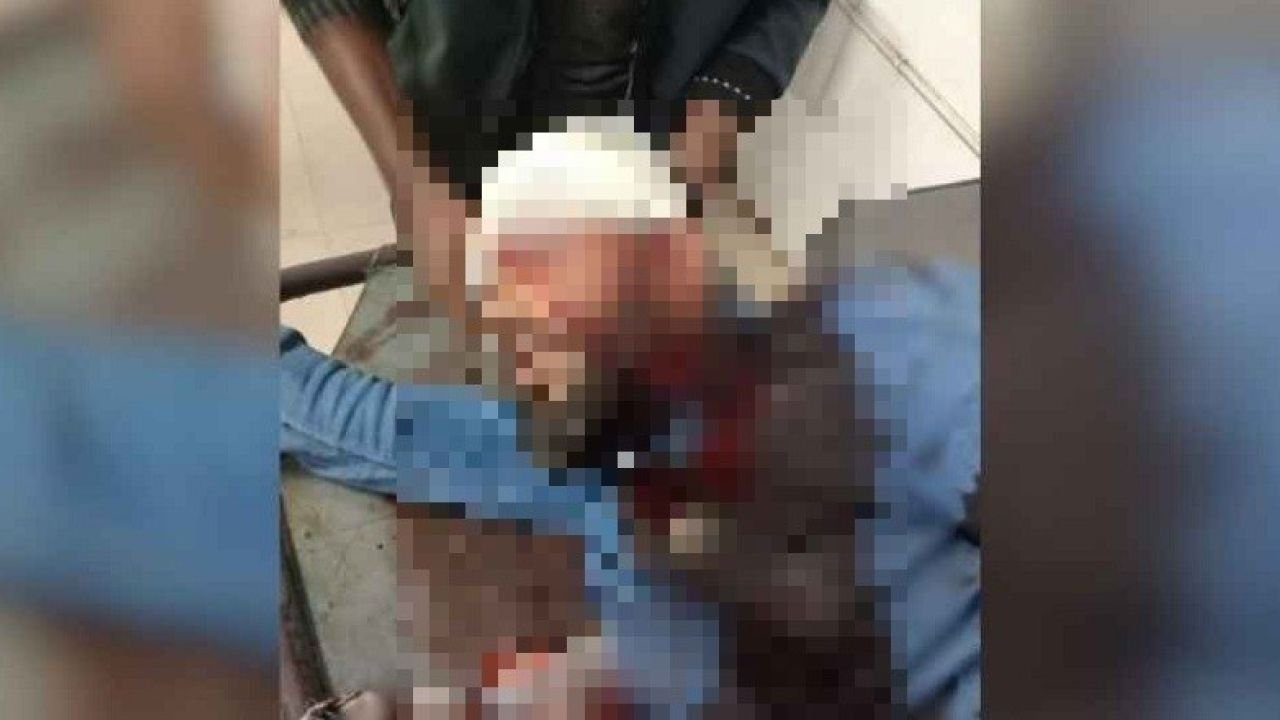 এবার এনসিপি নেতাকে প্রকাশ্যে গুলি