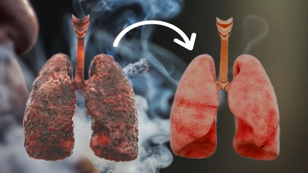 অতিরিক্ত ধূমপানে ফুসফুস ক্ষতিগ্রস্ত! নিয়মিত খান এই ৬ খাবার