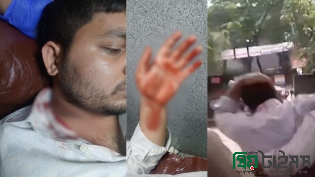 হাসপাতালে খুজে খুজে শিবির ও ছাত্রশক্তি নেতাদের ওপর ছাত্রদলের হামলা